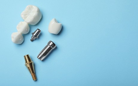 The parts of your dental implant also have separate costs