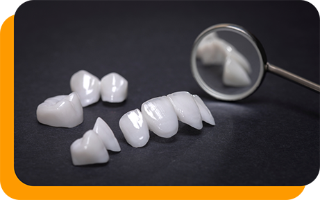 Several white dental crowns and veneers next to a dental mirror
