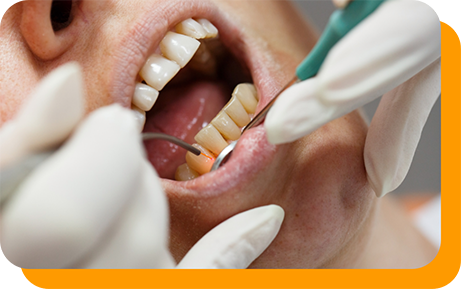 Dental patient receiving gum treatment with a soft tissue laser