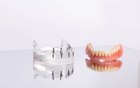 Lower arch of dentures one reflective surface next to clear base with implants