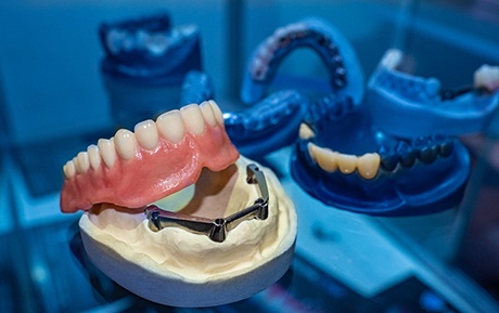 Lower arch of dentures resting on base of dental implants