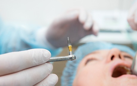 Closeup of dental implant about to be placed in patient’s mouth