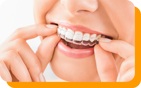 Close up of a person placing an Invisalign aligner over their teeth