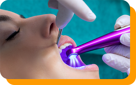 Dental patient having dental sealants applied to their teeth