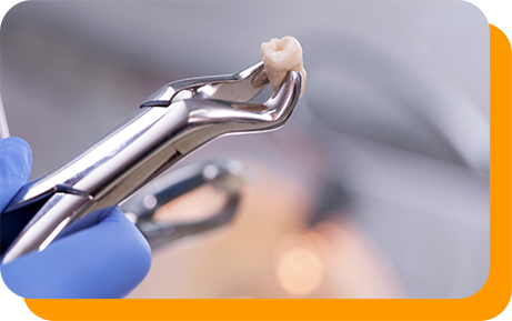Clasp holding an extracted tooth