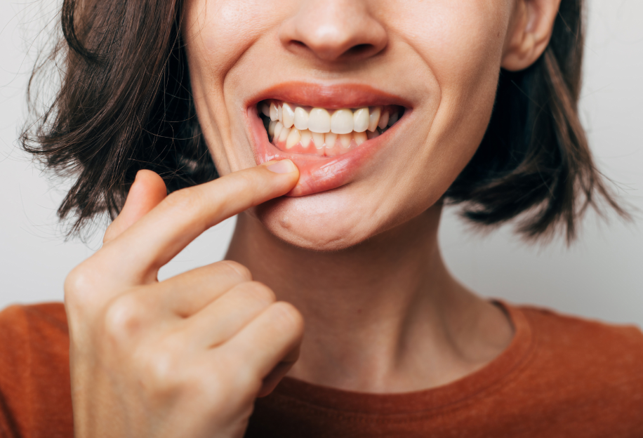 Woman pulling lip down to show gums